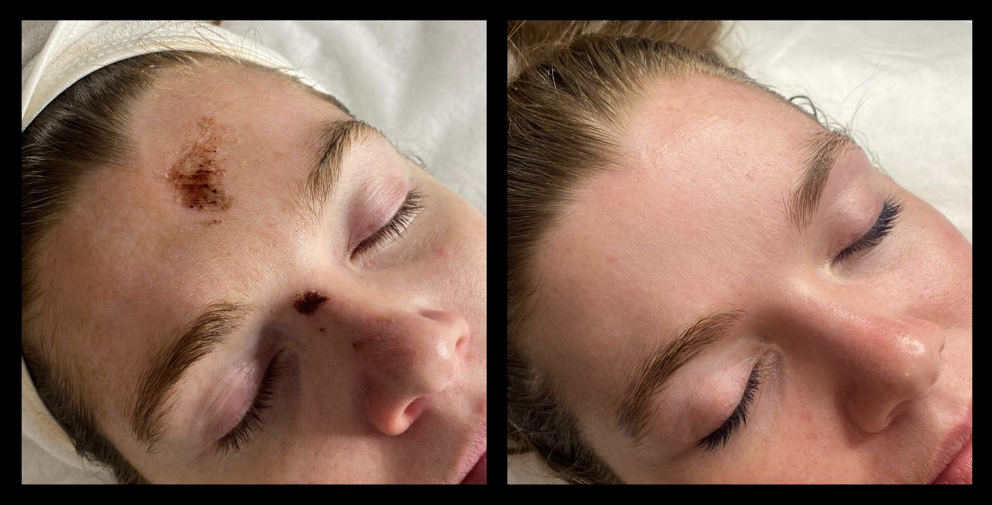 MediLUX LED before and after